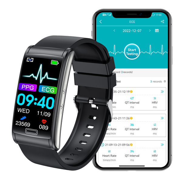 ECG Bracelet Blood Oxygen Blood Glucose Scientific Sleep HRV Smart Watch